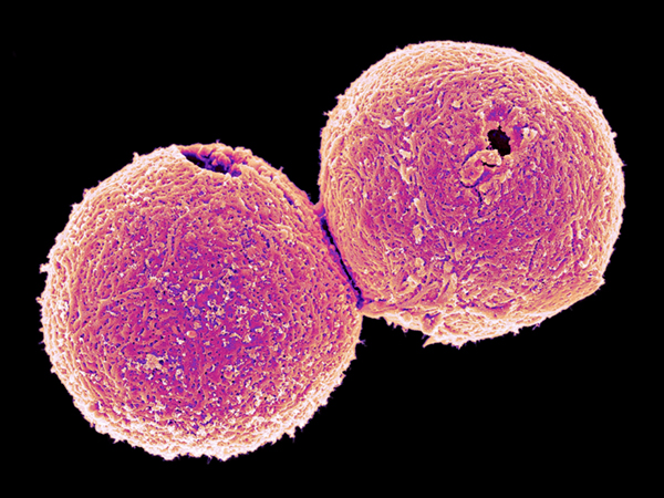 colored image of magnified sperm cells